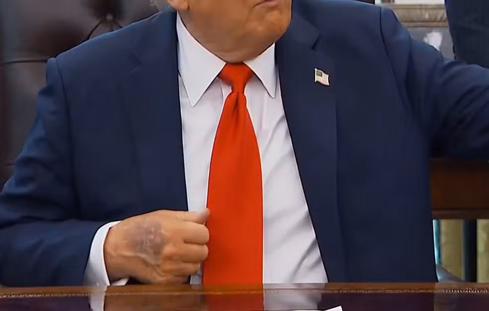 trump-maos-mancha-25ago2025