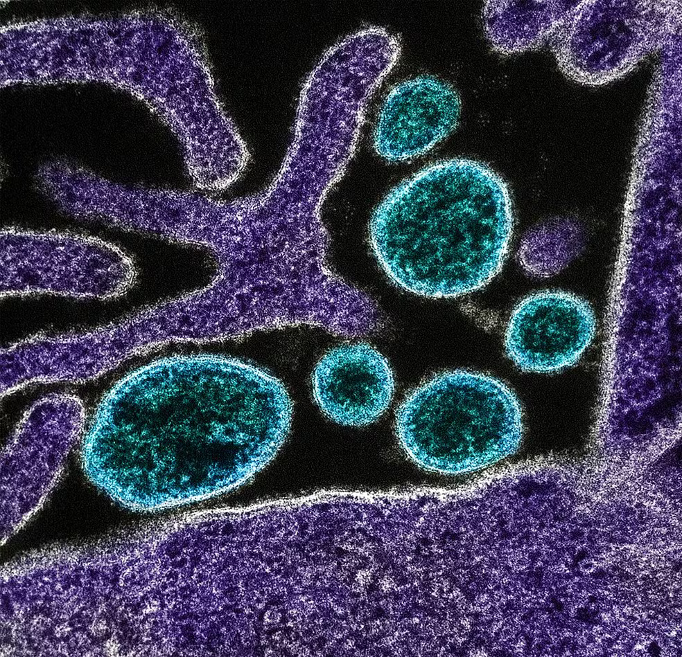 nipah
