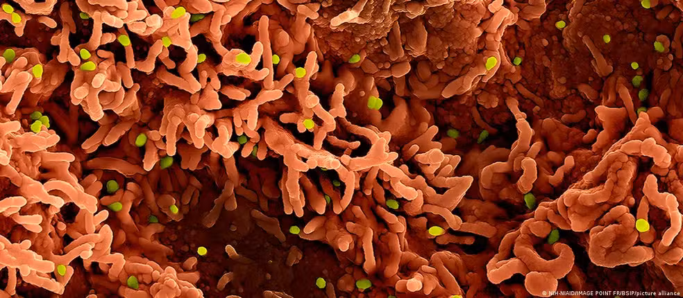 particulas-do-virus-mpox